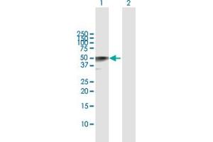 Western Blot analysis of CALR3 expression in transfected 293T cell line by CALR3 MaxPab polyclonal antibody. (Calreticulin 3 Antikörper  (AA 1-384))