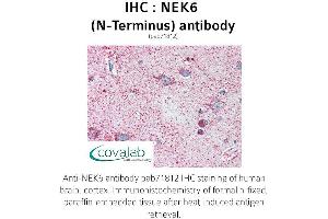 Image no. 1 for anti-NIMA (Never in Mitosis Gene A)-Related Kinase 6 (NEK6) (N-Term) antibody (ABIN1737252) (NEK6 Antikörper  (N-Term))