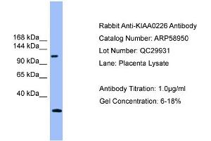 WB Suggested Anti-KIAA0226  Antibody Titration: 0. (Rubicon Antikörper  (Middle Region))