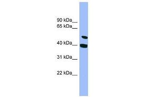SMU1 antibody used at 1 ug/ml to detect target protein. (SMU1 Antikörper)