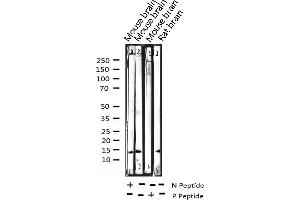 Western blot analysis of Phospho-Histone H2A. (H2AFX Antikörper  (pSer139))