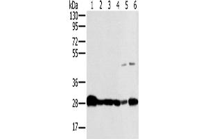 Western Blotting (WB) image for anti-NADH Dehydrogenase (Ubiquinone) Fe-S Protein 3, 30kDa (NADH-Coenzyme Q Reductase) (NDUFS3) antibody (ABIN2423863)