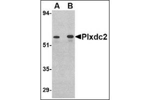 Western blot analysis of Plxdc2 in human colon tissue lysate with this product at (A) 0. (PLXDC2 Antikörper  (C-Term))