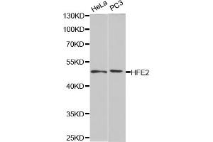 Western blot analysis of extracts of various cell lines, using HFE2 antibody (ABIN5973085) at 1/1000 dilution. (HFE2 Antikörper)