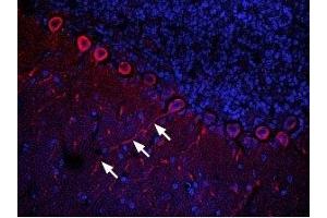 Expression of CXCR4 in rat cerebellumImmunohistochemical staining of rat cerebellum frozen section using Anti-CXCR4 (extracellular) Antibody (ABIN7043040, ABIN7044166 and ABIN7044167), (1:100). (Chemokine (C-X-C Motif) Receptor 4 (CXCR4) Peptid)