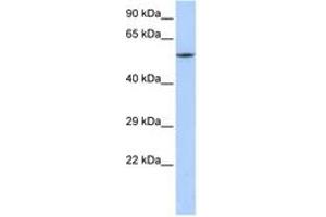 Image no. 1 for anti-Calcium Channel, Voltage-Dependent, beta 1 Subunit (CACNB1) (C-Term) antibody (ABIN6742715) (CACNB1 Antikörper  (C-Term))