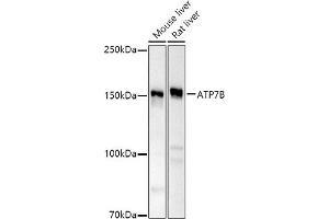 Western blot analysis of extracts of various cell lines, using B antibody (ABIN6127395, ABIN6137355, ABIN6137356 and ABIN6221328) at 1:500 dilution. (ATP7B Antikörper  (AA 1055-1354))