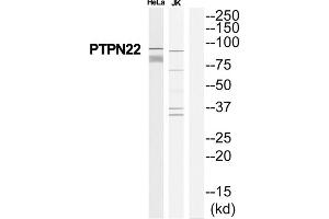 Western Blotting (WB) image for anti-Tyrosine-Protein Phosphatase Non-Receptor Type 22 (PTPN22) (Internal Region) antibody (ABIN1852320) (PTPN22 Antikörper  (Internal Region))