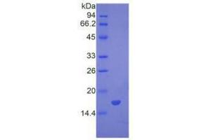 Image no. 1 for Bone Morphogenetic Protein 7 (BMP7) (AA 292-430) (Active) protein (His tag) (ABIN6239791)