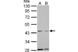 Western Blotting (WB) image for anti-Aurora Kinase A (AURKA) (C-Term) antibody (ABIN2855868)
