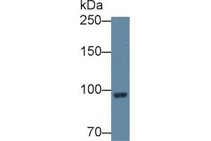 Detection of CFB in Rat Serum using Polyclonal Antibody to Complement Factor B (CFB) (Complement Factor B Antikörper  (AA 474-590))