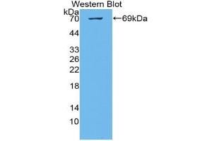 Western blot analysis of the recombinant protein. (KIAA1524 Antikörper  (AA 230-560))