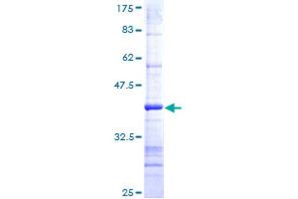 LYPLA1 Protein (AA 133-230) (GST tag)