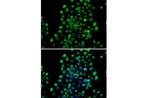 Immunofluorescence analysis of A-549 cells using NTMT1 antibody (ABIN6133076, ABIN6144899, ABIN6144900 and ABIN6222903). (METTL11A Antikörper  (AA 1-223))