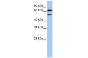 Image no. 1 for anti-F-Box Protein 7 (FBXO7) (C-Term) antibody (ABIN6740800) (FBXO7 Antikörper  (C-Term))