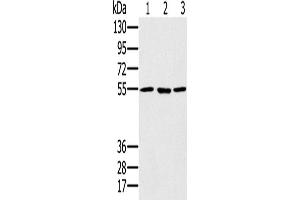 Western Blotting (WB) image for anti-Proteasome (Prosome, Macropain) 26S Subunit, ATPase, 1 (PSMC1) antibody (ABIN2424001) (PSMC1 Antikörper)