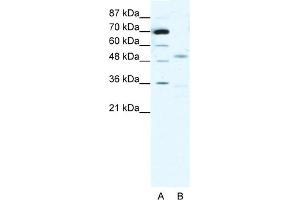 WB Suggested Anti-CHRNG Antibody Titration:  1. (CHRNA3 Antikörper  (N-Term))