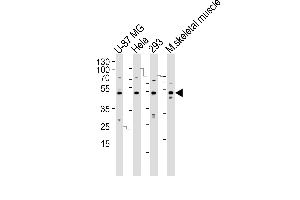 Western blot analysis of lysates from U-87 MG, Hela, 293 cell line and mouse skeletal muscle tissue lysate(from left to right), using SARS2 Antibody (N-term) (ABIN392300 and ABIN2841954).