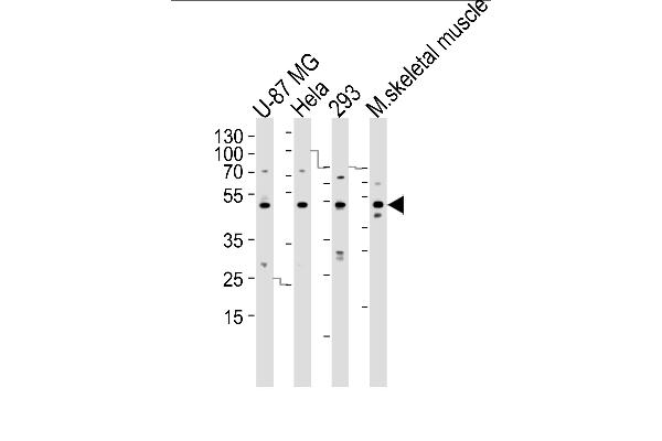 SARS2 anticorps  (N-Term)