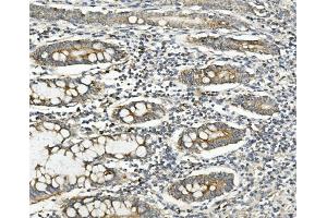 IHC analysis of Methylmalonyl Coenzyme A using anti-Methylmalonyl Coenzyme A antibody (ABIN7603112). (MUT Antikörper  (N-Term))