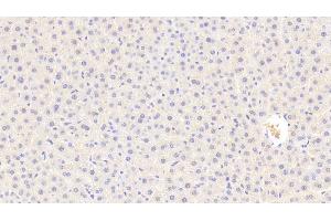 Detection of C5a in Rat Liver Tissue using Polyclonal Antibody to Complement Component 5a (C5a) (C5A Antikörper  (AA 12-64))