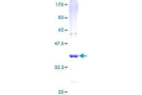 CHP Protein (AA 1-66) (GST tag)