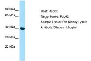 Image no. 1 for anti-Programmed Cell Death 2 (PDCD2) (AA 91-140) antibody (ABIN6749809) (PDCD2 Antikörper  (AA 91-140))