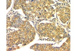 IHC analysis of GM130 using anti-GM130 antibody (ABIN6719432). (Golgin A2 (GOLGA2) (AA 796-913) Antikörper)