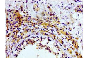IHC image of ABIN7127284 diluted at 1:100 and staining in paraffin-embedded human testis tissue performed on a Leica BondTM system. (Rekombinanter CD81 Antikörper)
