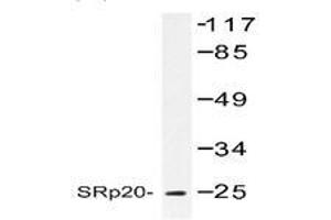 Image no. 1 for anti-serine/arginine-Rich Splicing Factor 3 (SRSF3) antibody (ABIN317610) (SRSF3 Antikörper)