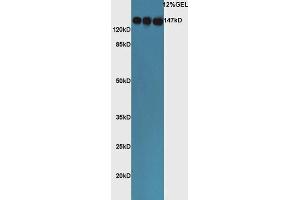 Lane 1: mouse lung lysates Lane 2: mouse liver lysates, Lane 3: mouse adrenal lysates probed with Rabbit Rabbit Anti-ACE Polyclonal Antibody, Unconjugated  at 1:5000 for 90 min at 37˚C. (Angiotensin I Converting Enzyme 1 Antikörper  (AA 801-900))
