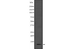 Western blot analysis of ANAPC13 expression in HEK293 cells ,The lane on the left is treated with the antigen-specific peptide. (ANAPC13 Antikörper  (Internal Region))