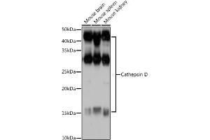 Western blot analysis of extracts of various cell lines, using Cathepsin D antibody (ABIN6127553, ABIN6139223, ABIN6139224 and ABIN6217233) at 1:1000 dilution. (Cathepsin D Antikörper  (AA 65-412))