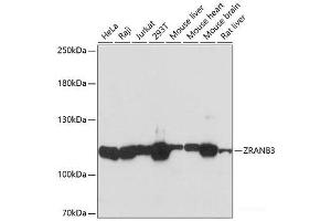 Western blot analysis of extracts of various cell lines using ZRANB3 Polyclonal Antibody at dilution of 1:3000. (ZRANB3 Antikörper)