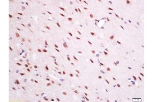 paraformaldehyde-fixed, paraffin embedded mouse brain tissue; Antigen retrieval by boiling in sodium citrate buffer(pH6) for 15min; Block endogenous peroxidase by 3% hydrogen peroxide for 30 minutes; Blocking buffer (normal goat serum) at 37°C for 20min; Antibody incubation with Rabbit Anti-QRFP Polyclonal Antibody, Unconjugated  at 1:200 overnight at 4°C, followed by a conjugated secondary and DAB staining (Neuropeptide Antikörper  (AA 91-133))
