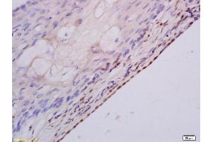 Formalin-fixed and paraffin embedded rat ovary labeled with Anti MSH3 Polyclonal Antibody, Unconjugated (ABIN1387851) at 1:200 followed by conjugation to the secondary antibody and DAB staining (MSH3 Antikörper  (AA 521-620))