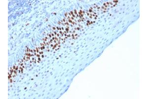 Formalin-fixed, paraffin-embedded human Skin stained with Ki67 Mouse Monoclonal Antibody (MKI67/2463). (Ki-67 Antikörper  (AA 2293-2478))