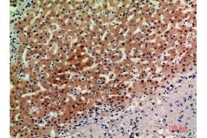 Immunohistochemical analysis of paraffin-embedded human-liver, antibody was diluted at 1:200 (ACER2 Antikörper  (Internal Region))