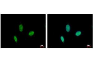 ICC/IF Image RAD23B antibody detects RAD23B protein at nucleus by immunofluorescent analysis. (RAD23B Antikörper  (Center))