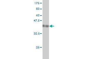 Western Blot detection against Immunogen (37.