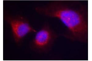 Immunofluorescence staining of methanol-fixed HeLa cells using Phospho-SYK-Y323 antibody (ABIN2987845).