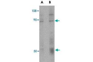 Western blot analysis of CD248 in human colon tissue lysate with CD248 polyclonal antibody  at (A) 0. (CD248 Antikörper  (C-Term))