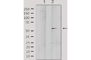 Western blot analysis of extracts from Hela, using MMP1 Antibody. (MMP1 Antikörper  (C-Term))