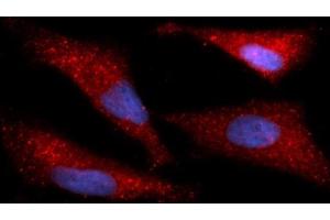 Immunofluorescence (IF) image for anti-Immunoglobulin Binding Protein (BIP) (AA 20-650) antibody (APC) (ABIN5566439) (BIP Antikörper  (AA 20-650) (APC))