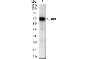 Western Blotting (WB) image for anti-Matrix Metalloproteinase 2 (MMP2) (AA 242-396) antibody (ABIN1844833) (MMP2 Antikörper  (AA 242-396))