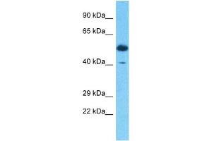 Host:  Rabbit  Target Name:  SERPINB3  Sample Type:  Thymus Tumor lysates  Antibody Dilution:  1. (SERPINB3 Antikörper  (C-Term))
