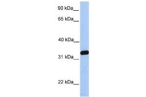 NKIRAS2 antibody used at 1 ug/ml to detect target protein. (NKIRAS2 Antikörper  (C-Term))
