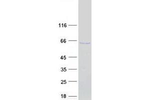 Western Blotting (WB) image for Interferon Regulatory Factor 5 (IRF5) (Transcript Variant 1) protein (Myc-DYKDDDDK Tag) (ABIN2723539)