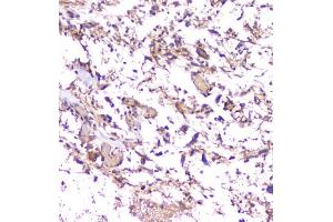 IHC-P: Amyloid beta antibody testing of mouse brain tissue. (APP Antikörper  (C-Term))