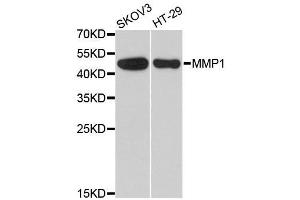 Western blot analysis of extracts of various cell lines, using MMP1 antibody. (MMP1 Antikörper  (AA 20-280))